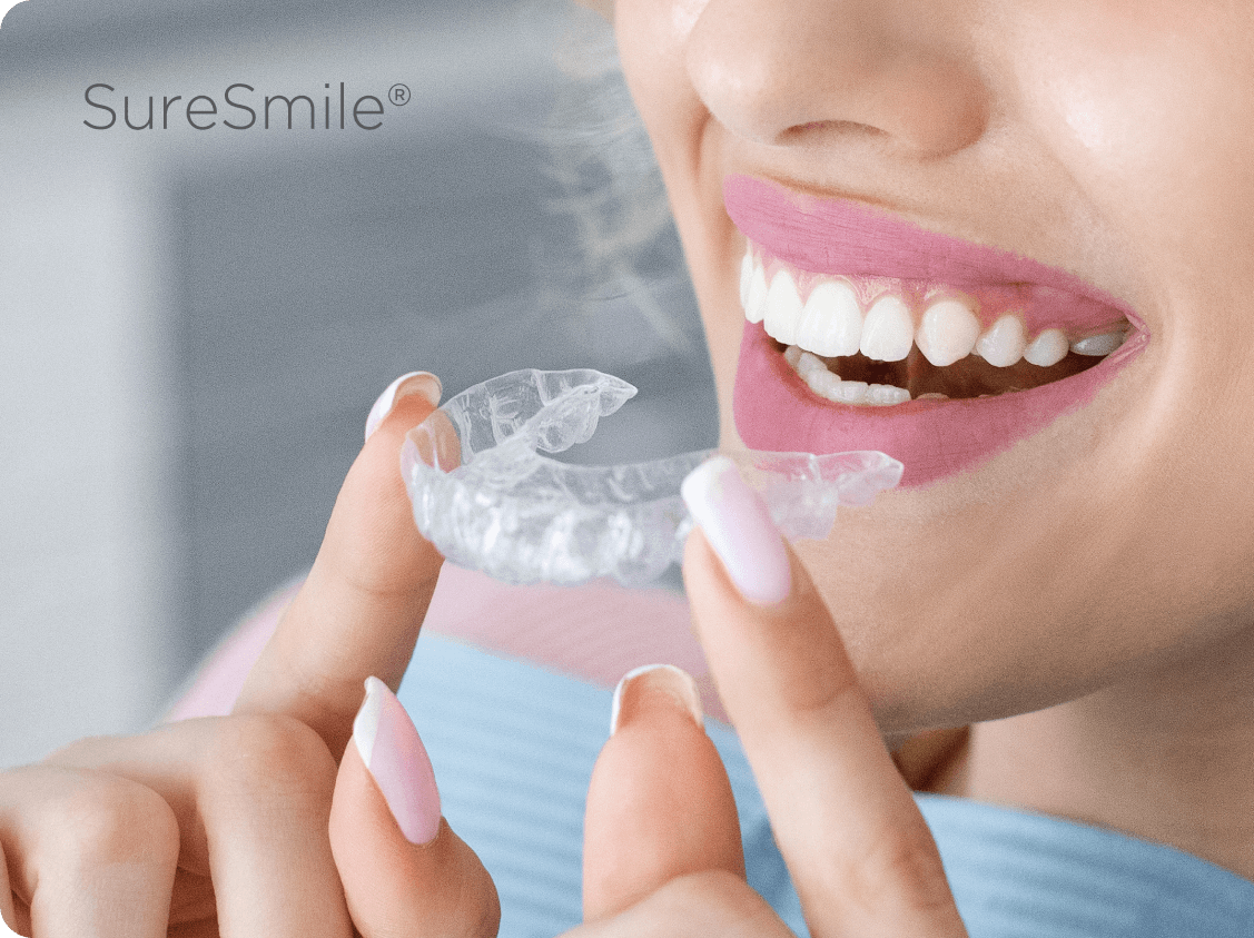 SureSmile Clear Aligners